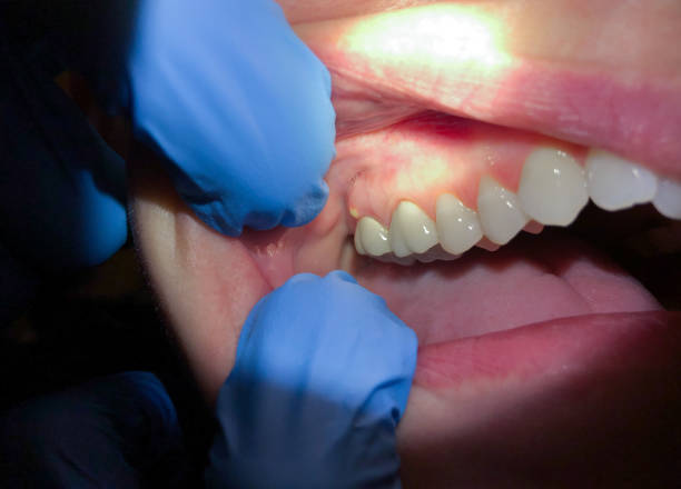 Best Pediatric Emergency Dentist in Canaan, CT